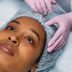 Botox Fillers - Dermatologist Injecting Botox on Client's Forehead